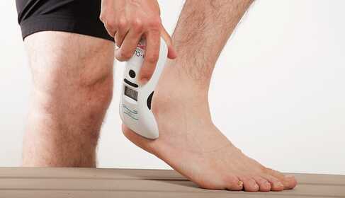 Softlaser voor behandeling van hielpijn – hielspoor, plantaire fascitis