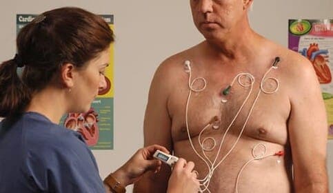 Wat je moet weten over de Holter EKG-onderzoek