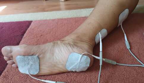 Achillespeesontsteking en behandeling thuis