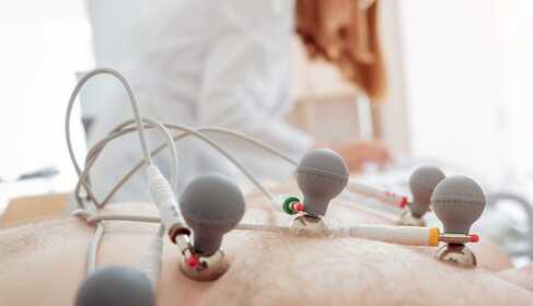 EKG – wat je over het elektrokardiografisch onderzoek moet weten