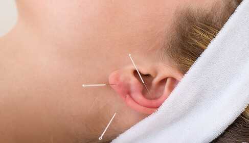 Acupunctuur — mystiek of biofysica?