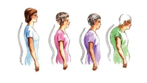 Osteoporose en magnetotherapie – Aanvullende thuisbehandeling
