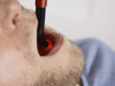 Softlaser in de tandheelkunde: behandeling van mondklachten thuis