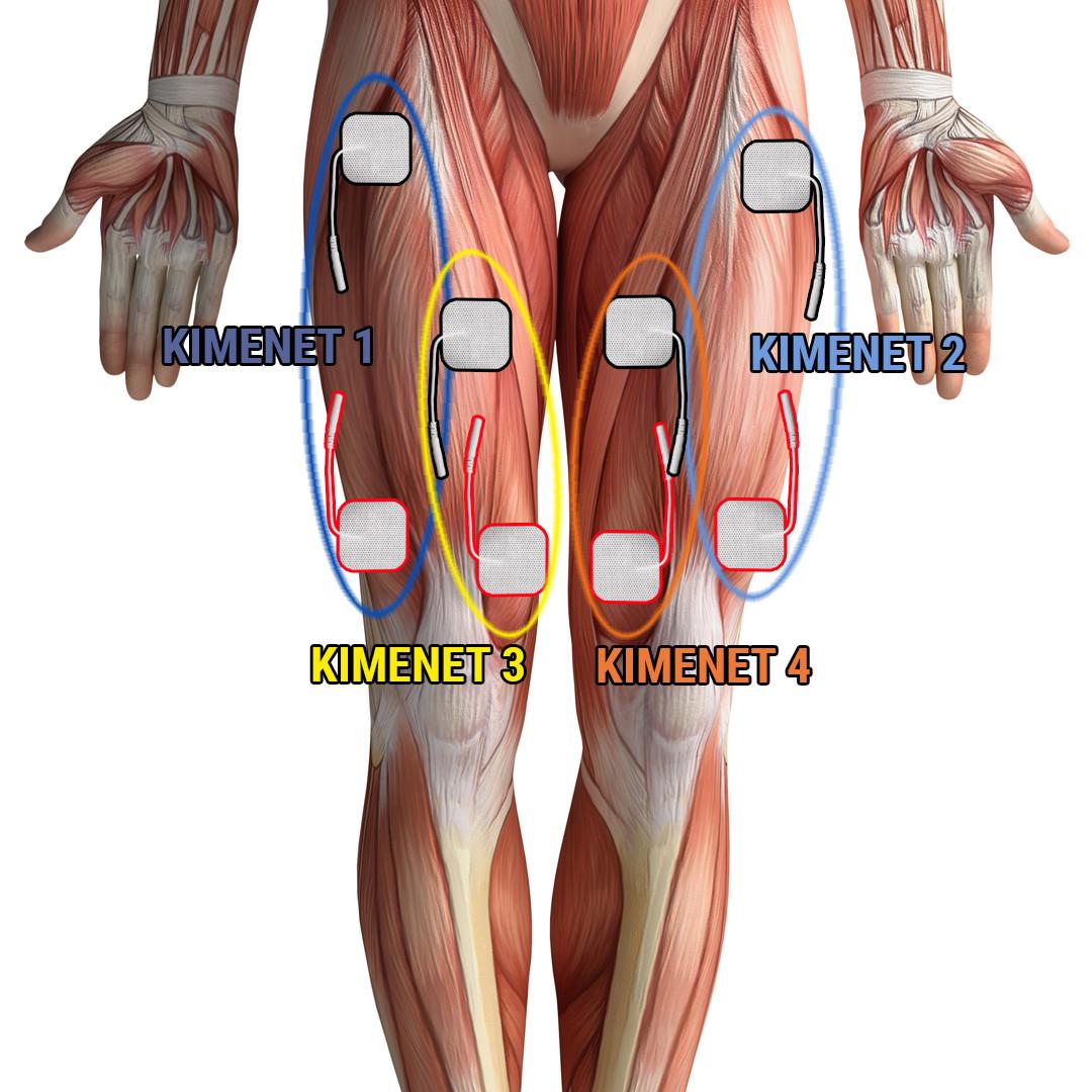 combizom-Quadriceps-erosites.jpg