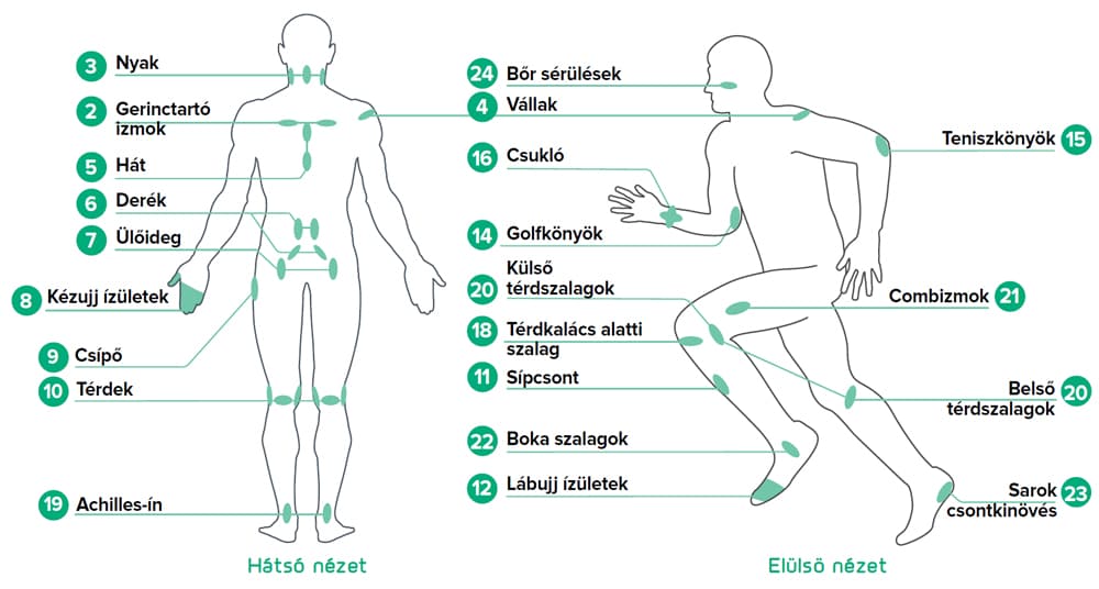 B-Cure sport laser behandelpunten