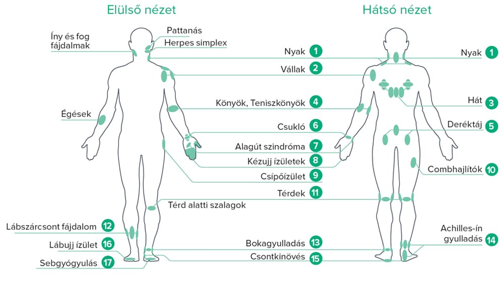 B-Cure laser behandelpunten